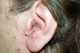 How To Tell If You Have An Ear Infection