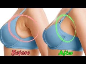 How TO Get Rid Of Side Boob Fat