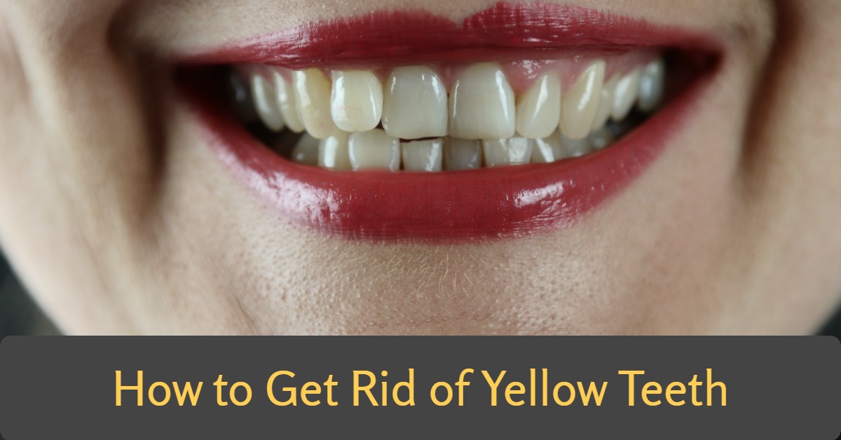 How to Get Rid of Yellow Teeth (10 Best Metthods)