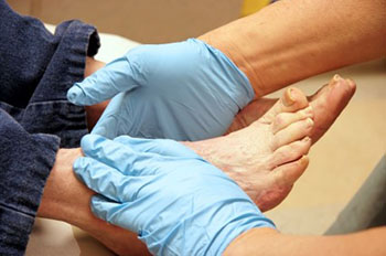 How To Treat Cold Feet(Step and Requirements)