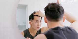 How To Cope With Baldness And Hair-loss