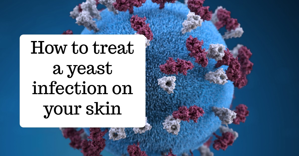 How to Treat a Yeast Infection on Your Skin