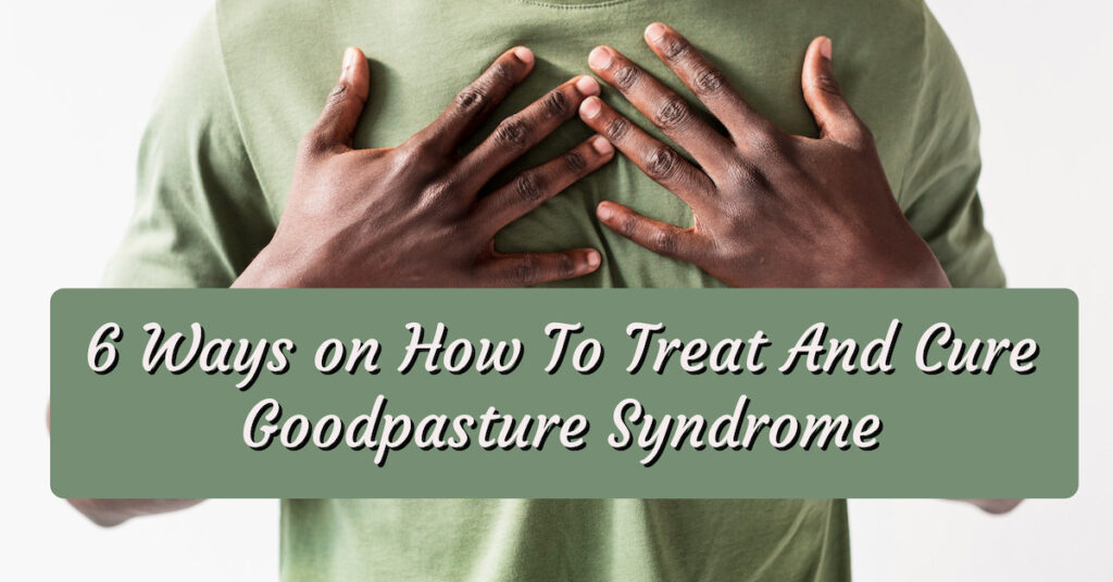 6 Ways on How To Treat And Cure Goodpasture Syndrome