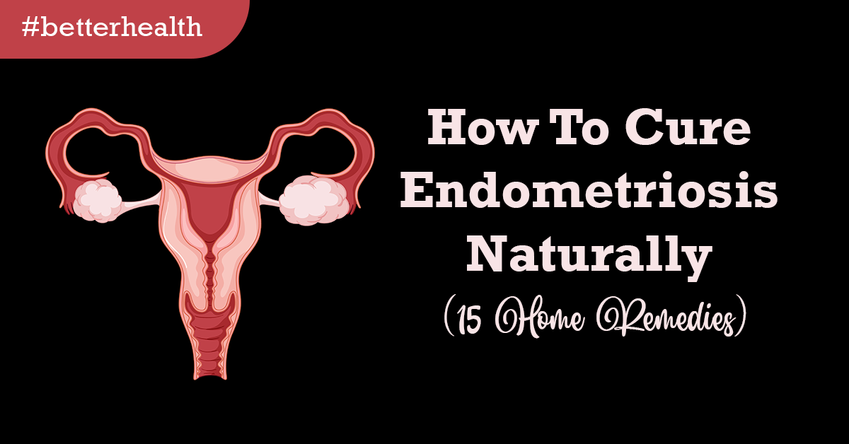 How To Cure Endometriosis Naturally (15 Home Remedies)