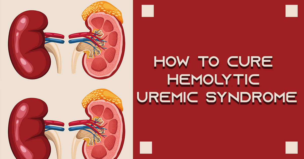 How To Cure Hemolytic Uremic Syndrome