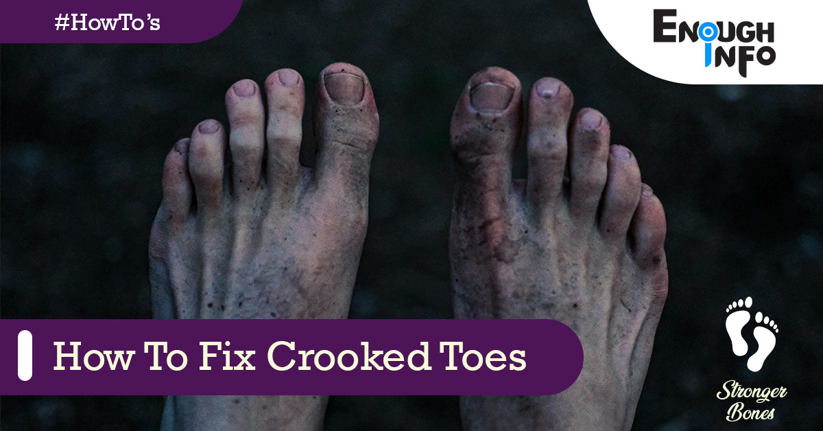 How To Fix Crooked Toes (All you need to Know)