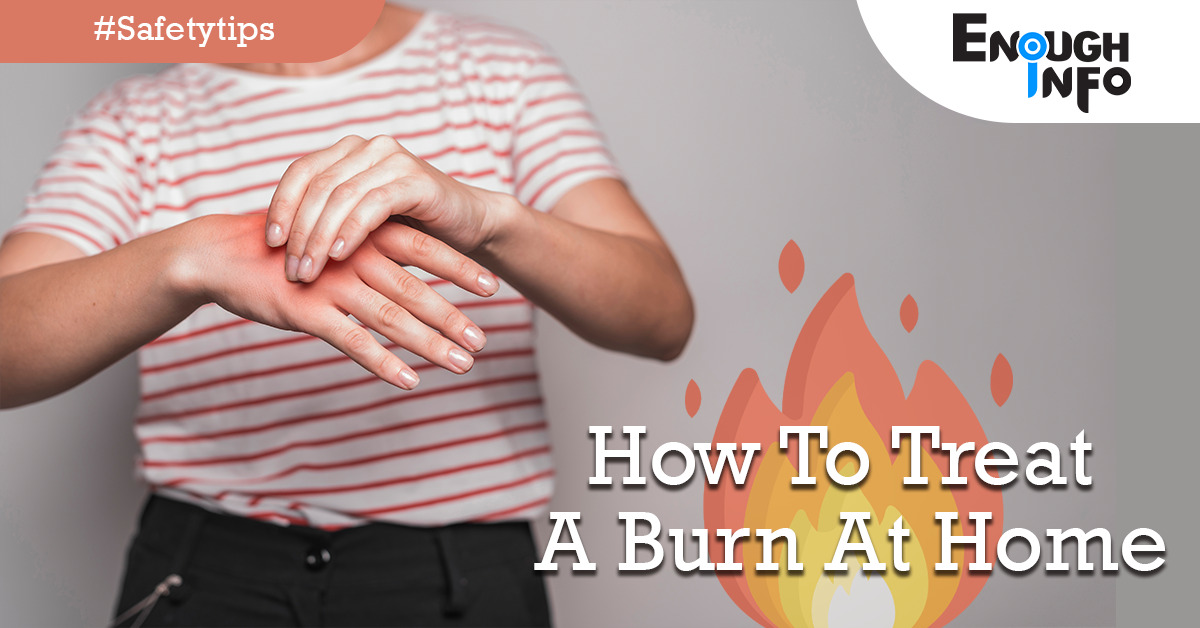 How To Treat A Burn At Home