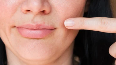 How to get rid of small bumps on the lips (The Ultimate Guide)